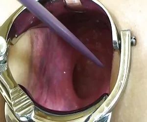 La esposa extremas elmer - anal están abiertos!- videos porno caseros